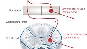 المحرك العلوي والسفلي العصبون العصبون المحرك العلوي (UMNs) Upper motor neurons - يتوضع في قشر الدماغ أو تصدر عنه السبل القشرية الشوكية - يتوضع أيضا في جذع الدماغ التي تسيطر على العصبونات المحركة