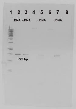 ودراسة تعبيرها الجيني في مشيقات L.tropica في الليشمانية المدارية دراسة تواجد جين الليشمانية المداريةPromastigote الشكل 4: رحالن جين ونالحظ ظهور 4 عصابات بطول 323 زوج أساس في اآلبار 2 و 3 و 5 و 3.