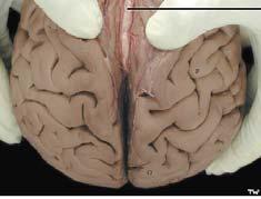 Cerebrum المخ يتشكل الدماغ اإلنتھائي Telencephalonمن نصفي كرة مخية hemisphere (تحوي قشرا سنجابيا cerebral