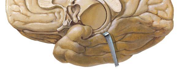 Amygdaloid body ينتھي الذيل بالجسم اللوزي الجسم اللوزي: في مقدم الصدغي, أمام الحصين, قسم من الجھاز الحوفي نويات إنسية ومركزية (شمية) منھا الحزمة اإلنتھائية (سطر انتھائي) بصرية ( (سمعية, ي وحشية