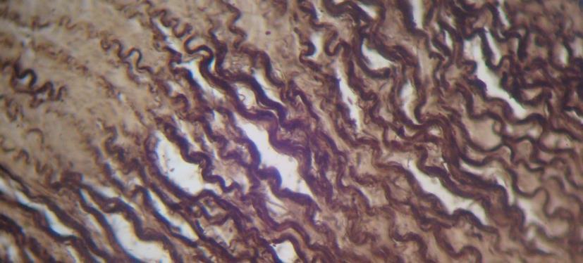 10 النسيج الض ام علم األنسجة 1 1 Histology السالم عليكم و رحمة اهلل و بركاته نكمل معكم اآلن محاضرتنا باستئناف الحديث عن النسيج Pdf Free Download
