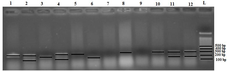 ... from Characterization of Escherichia Coli 38 Figure (1): Triplex PCR profiles specific for E. coli phylogenetic groups.
