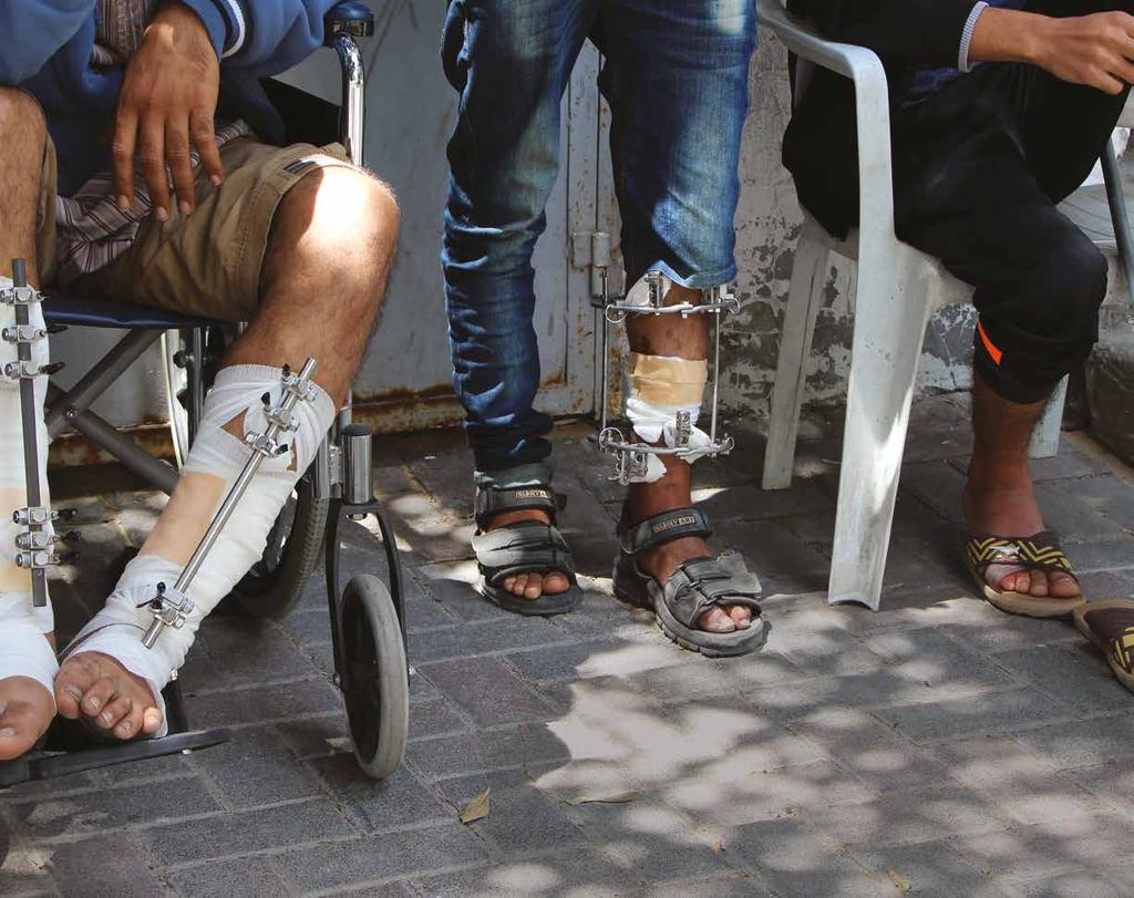 تحت الضوء الصور: لوري بون و/أطباء بال حدود متظاهرو غزة منذ الثالثني من مارس/آذار 2018 أصيب آالف املتظاهرين الفلسطينيني برصاص الجيش اإلرسائييل أثناء مسرية العودة الكربى.
