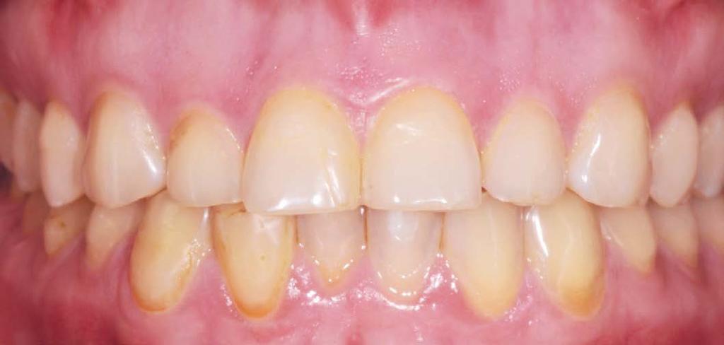 These include a very systematic prosthodontic treatment plan and clinically proven materials.