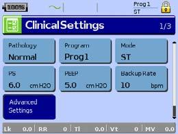 قائمة اإلعداد قائمة اإلعداد: Clinical Settings (اإلعدادات السريرية) (نوع القناع) اضغط لعرض شاشة Clinical Settings (إعدادات