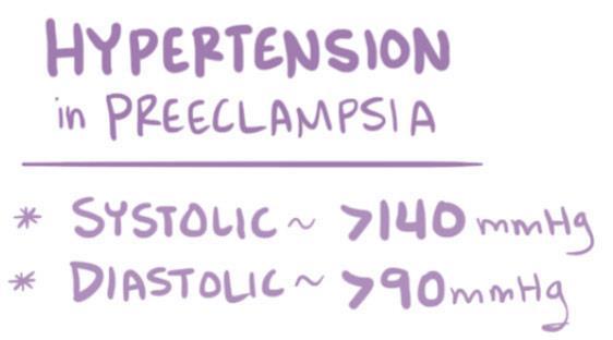Eclampsia Preeclampsia ما قبل اإلرجاج - اإلرجاج هام 20 يعر ف ماقبل اإلرجاج بأنه: مترافق مع واحد أو أكثر مما يلي: ارتفاع توت ر شرياني > 90/140 بعد األسبوع ملم.ز للحمل بيلة بروتينية > 300 مغ/ 24 سا.
