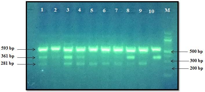 الشكل )1( : تبين ناتج تفاعل ال PCR الخاص بالتباين الو ارثي للجين (A1298C) MTHFR في مجموعة النساء ذوات الجهاض المتكرر إذ إن M تمثل العينات الحاملة للنمط الو ارثي المتباين )AC( بناتج التفاعل يحوي ثالثة