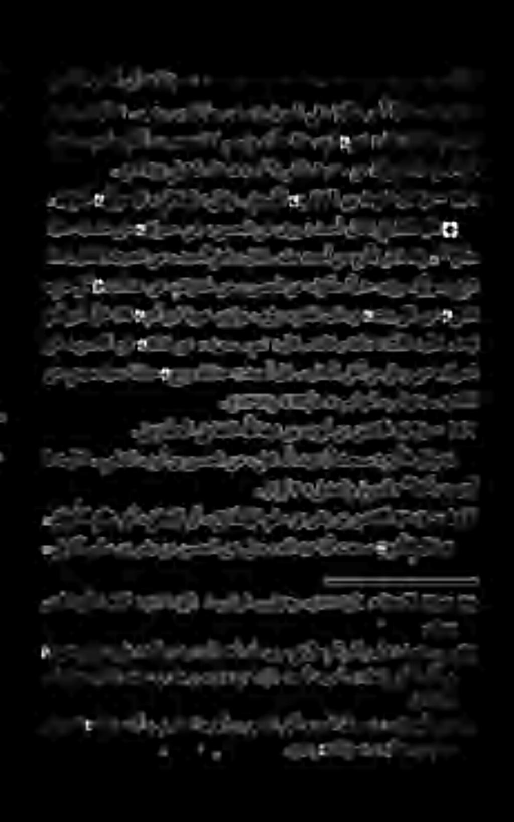 مربكألا بكبيأ تالاؤسس ١1 ) ٩۰ (.» هتالاوس» 0 دلاخ نب ماصع. (۳۳ )0 يليقعلا ءافعض «. )6 سانلا ثیدح نم نافورعم امهو بع ش ثیدحنمامهرکنآ,بجعتملاکمسبتو «ا مح اذهیرت» معن : لاق دلاخنب دبع ثیدح : تلقف.