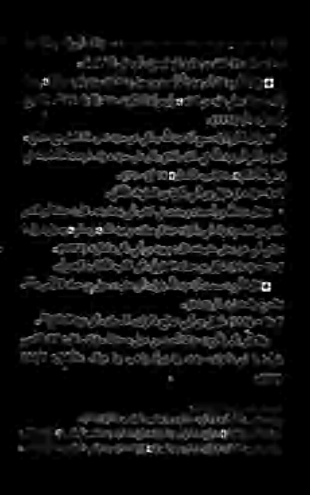 حرجلا «. "'قدصلاب الإ ثدح نوكي النأوجرأو» هباتك نم هيلع يلمي اججاجح تيأر. ب ي ت ح ملا ىلع وبأ.