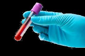 There are several tests that identify such antibodies, being the most common the
