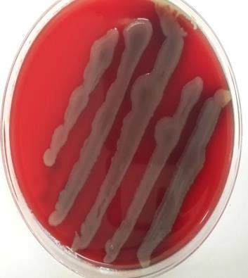 ب وسط اختياري لبكتريا Bacillus cereus Selective ا ضر هذا الاسر Agar base (MYP) 43 g م اسر اسب تعل مةت الشرفة المينعة تإذاتة المة المارر الفمي الامت ال 9 ml تل 1 ml م ثت عات تمكة المؤيدا تدرمة ا اررا