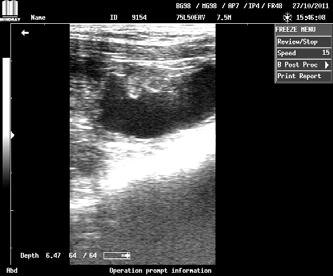 تصحيح أطوال فترة الحمل من خالل معرفة تاريخ الوضع. كما درست بعض المؤشرات الجنينية على جزء من قطيع الماعز( 85 عنزة: ٢٢ عنزة تلقح ألول مرة والباقي سبق لھا أن ولدت).