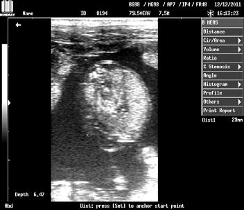 قياس قطر الجسم Transversal abdominal diameter بعمر ٥٦ يوم قياس