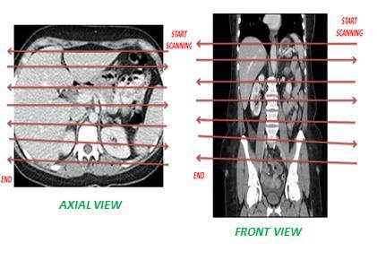 Figure 2.8: CT Scanning Process( Guite et al., 2013).