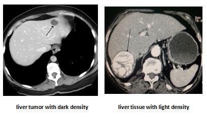 of anatomy of the normal parts and it locations the diseased part can be also located which usually appears different, for example in