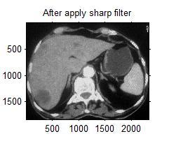 Figure 4.3: Slide Crop Process. Figure 4.4: Intensities Distributions of The Slide Cropped Smoothed Image. Figure 4.5: Image after using the Sharpen Filter. Figure 4.6: Intensities Distributions of the Slide Cropped Sharping Image.