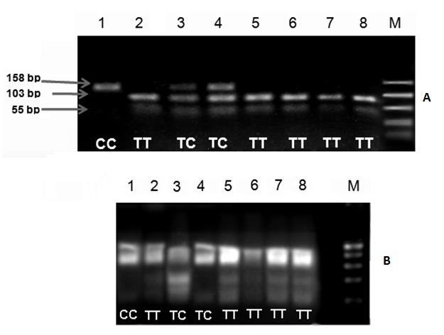 ADRB3 تطوير طريقة معدلة الكتشاف التعددية الشكلية وحيدة النوكليوتيد Trp64Arg في جين المستقبل األدريني بتعريض الهالمة لألشعة فوق البنفسجية في جهاز إظهار وتوثيق الهالم video documentation system.