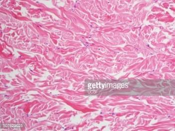 النسيج الضام 8 10 2018 د عبد الحافظ طبش Histology 1 علم األنسجة 1 السالم عليكم أصدقائي نتابع وإياكم رحلتنا في مادة علم النسج راجين من اهل Pdf Free Download