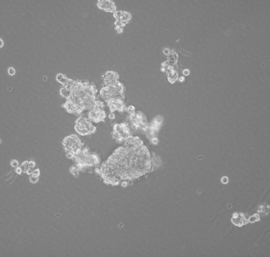 حفظ خاليا BCSCs باآلزوت السائل Preservation in Liquid Nitrogen تم زرع خاليا BCSCs في الوسط المغذ ي DMEM/10%FBS إلى أن نمت لتصل إلى %80 من حد التمادي األعظمي.