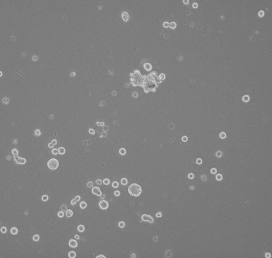 مقارنة جمهرة خاليا الثدي الجذعية السرطانية بجمهرات مختلطة لخاليا ورم ثدي Mixed Tumor قمنا بمقارنة خصائص الخاليا المغناة إلحدى الن سائل المعزولة مع خاليا ورمي ة ثديي ة لم تخضع لعمليات االنتقاء