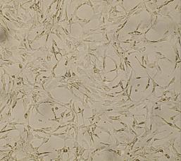 مقاومة خاليا BCSCs