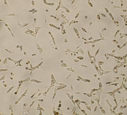 ng/ml  BCSCs 0