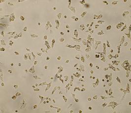 من خاليا BCSCs
