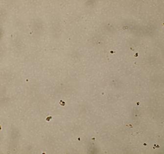 استطاع دوكسوروبيسين بتركيز قدره 5 مكغ/مل القضاء على خاليا BCSCs بصورة تام ة )الش كل C( 6 في حين قاومت هذه الخاليا الدوسيتاكسل بتراكيز وصلت 5 مكغ/مل )الش كل B6( بحيث استعادت الشكلياء النمطية والمشابهة