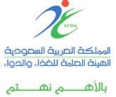 نة وا ن يكون حاUشل على Tشهادة بكالوريو ض الطب مع اإ ام شنة المتياز وحاUشل كذل على درجة ٦ على الا قل في اختبار «الايلتس» ا و ما يعادلها في التوفل وس تكون الا فض لية لمن له درجات ا على مع ض رورة