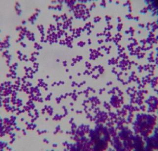 البكتريا المرضية محاضرة )71( S. epidermidis coagulase negative بتبمو ق ب بسط المادتو الم حا سشك مةتعمراع بتةية ال ون. قاةة تكون تواجبها حبيعا ب ير المباقة بقبب بات الة.