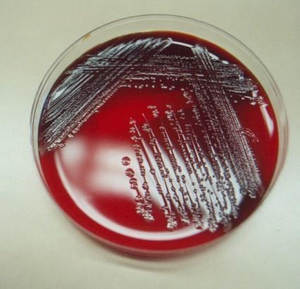 البكتريا المرضية محاضرة )71( hydrochloride) ق درة مد المح دو مدع البكتريدا ق دب بتق البشداف filter paper تتحدو البكتريدا الدب الببفةدجا اب اختجوادا purple الرامق.