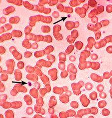 تمثل الهيموجلوبين بإنها مادة كيميائية توجد في خلايا الدم الحمراء .