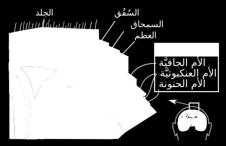 يكون مملوءا بالسائل النخاعي الدماغي.