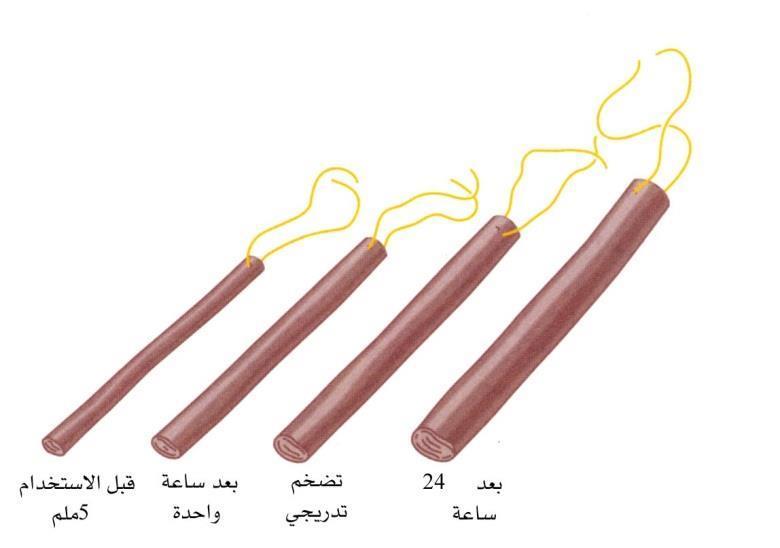 الشكل 4-27 أعواد الالميناريا )موسعات