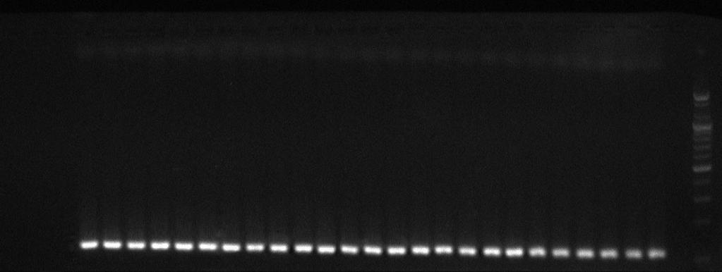 الفصل الثالث النتائج والمناقشة DNA ladder وبالمقارنة بين الحزم المتضاعفة والحزم التابعة الى acrb الدليل الحجمي وجد ان الحزم.