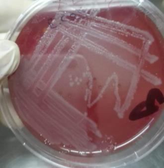 E coli على عدة اوساط تشخيصية وهي )3- مستعم ارت وردية على الشكل