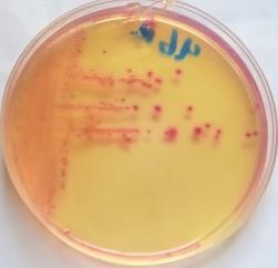 معدنية لماعة على االيوسين مثيلين اكار وسط Blood االزرق -3 Eosin