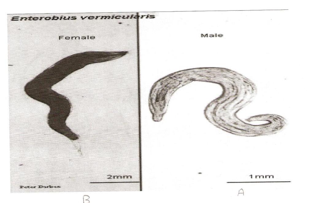 Enterobius vermicularis oms. Alyaa Gad - Pinworm giardia fertozes