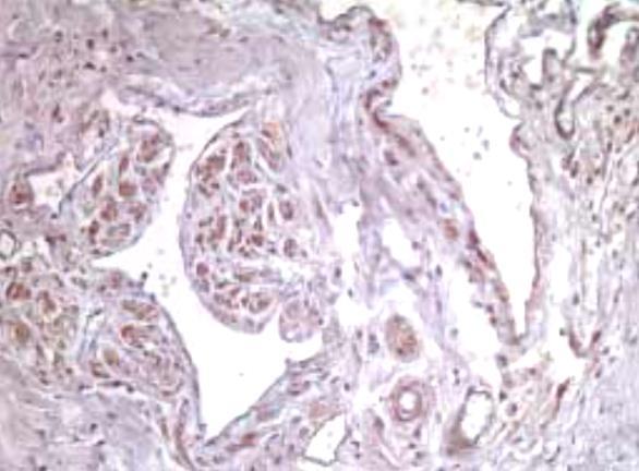 Mohammad A. Randhawa & Mohamed Soliman: A review of the developmental, structural, biochemical,... nis of the male and likewise consists of cavernous tissue.