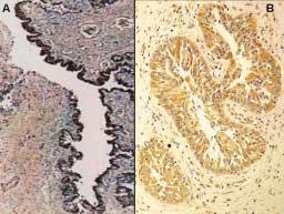 1 Biochemical factors of male erectile tissue Corpus cavernosum smooth muscle tone regulates penile flaccidity and erection (Figure 7).