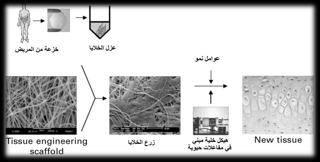 Human chondrosarcoma cells