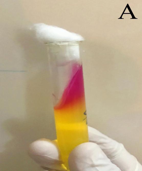 Protease وعدم قدرة ىاتين العزلتين عمى إنتاج ال Hemolysin بينما أظير العدد األكبر من البكتريا الالشائعة وبواقع 2 عزالت إيجابية لعاممين فقط من عوامل الض اروة حيث أظيرت كل من بكتريا Alloiococcus Otitis