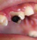 25 ثنائي هيدروك سي فيتامني د( وكذلك اإنزمي العظام الفو سفاتاز القلوي Phosphatase(.)Alkaline حتليل ن سبة الكال سيوم والفو سفات يف البول ون سبتهما اإىل الكرياتينني البويل. حتليل وظائف الكلى.