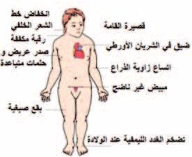 الإ سابة املر سية احلاد ة اأو العملي ات اجلراحي ة ملنطقة اخل سية. اللتهابات الفريو سي ة للخ سية مثل فريو ص النكاف. اأمرا ص املناعة الذاتي ة للخ سية. التواء اخل سيتني Torsion(.