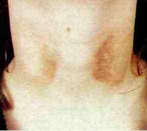 diseases وبالتال... أي حد أالق lesion ف رجله أو إ ده... الزم أسئله عن شغلته.