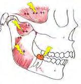b. Dental Pain of Periodontal Origin Periodontal pain is deep somatic pain of the musculoskeletal type because of presence of proprioceptor fibers. Patient can localize the pain of periodontal origin.