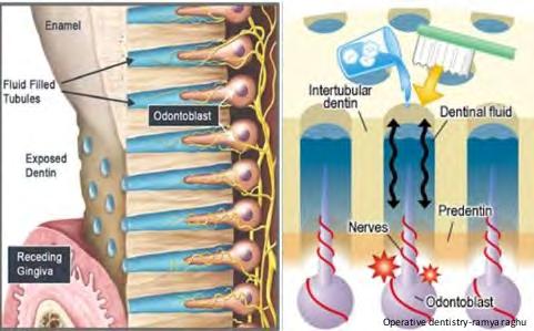 Diagnosis 1. Apply the irritant which starts the painful reaction-hot or cold, sweet or sour or scratching with an instrument. 2.