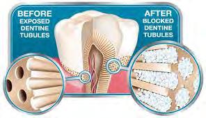 anatomical diameter of the tubules so as to limit the fluid movement.