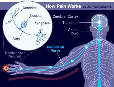 Orofacial pain, like pain elsewhere in the body, is usually the result of tissue damage and the activation of nociceptors, which transmit a noxious stimulus to the brain.