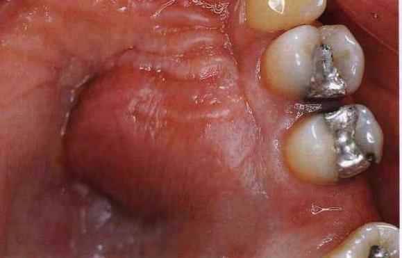 ٴ Diagnosis 1. Spontaneous dull, throbbing or persistent pain is present. 2.